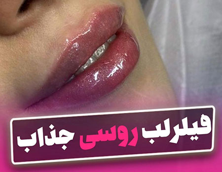 فیلر لب