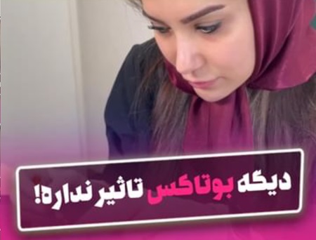 بوتاکس