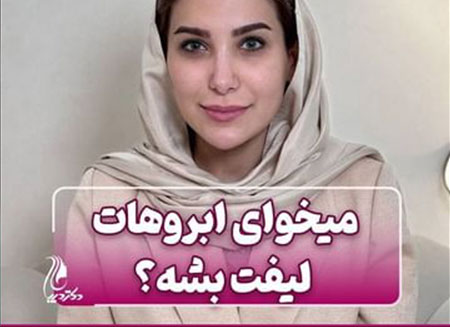 لیفت ابرو