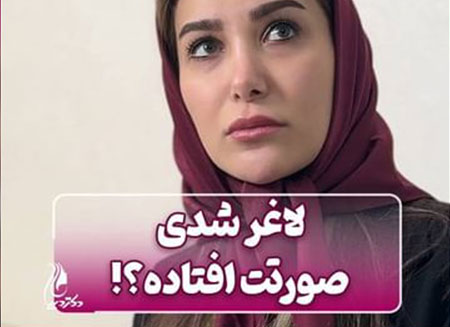لاغری و افتادگی صورت