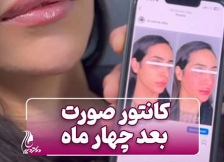کانتور صورت