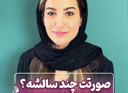 سن صورت