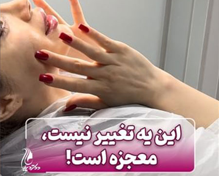 لب نچرال | دکتر سارینا دیباوری | کلینیک دکتر دیبا | پزشک پوست، مو و زیبایی شهر قدس