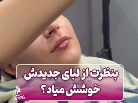 لب روسی نچرال | بهترین کلینیک تزریق فیلر لب روسی شهر قدس | دکتر سارینا دیباوری | کلینیک دکتر دیبا | پزشک پوست، مو و زیبایی شهر قدس