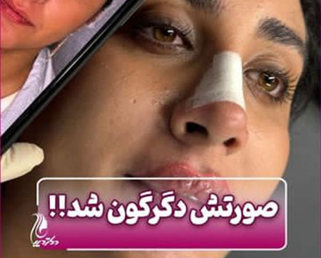 بهترین مرکز تزریق فیلر لب روسی شهر قدس | دکتر سارینا دیباوری | کلینیک دکتر دیبا | پزشک پوست، مو و زیبایی شهر قدس