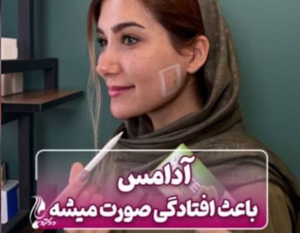 آدامس باعث افتادگی صورت می شود | دکتر سارینا دیباوری | کلینیک دکتر دیبا | پزشک پوست، مو و زیبایی شهر قدس