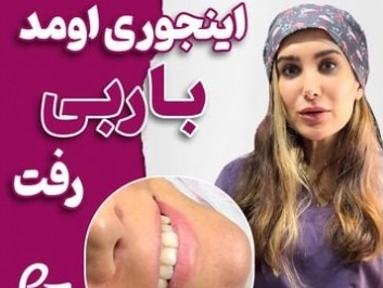 اصلاح فرم لب | فیلر لب | دکتر سارینا دیباوری