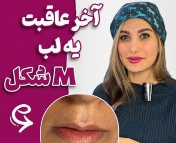 اصلاح لب M شکل| تزریق فیلر | دکتر سارینا دیباوری