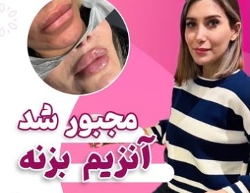 تزریق آنزیم | دکتر سارینا دیباوری