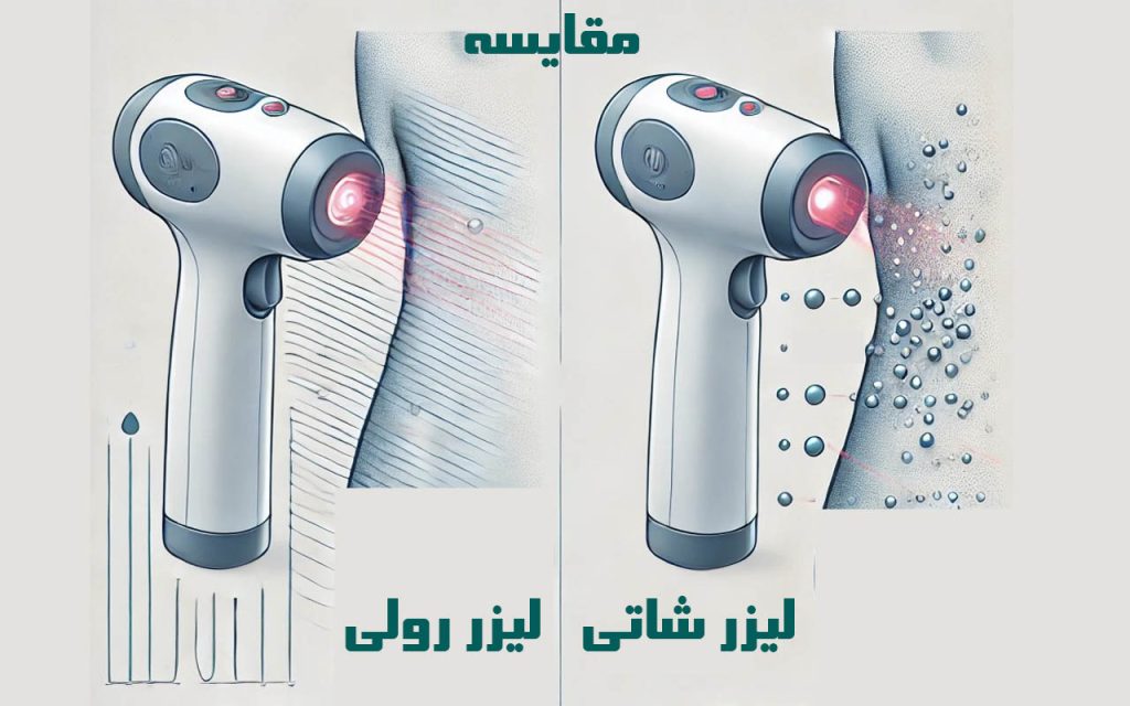 تفاوت لیزر رولی و لیزر شاتی | دکتر دیبا