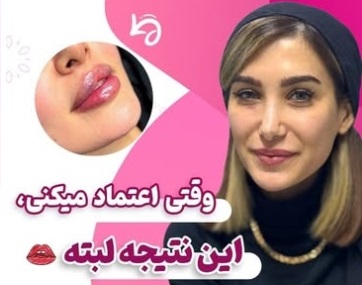 تزریق آنزیم | دکتر سارینا دیبا